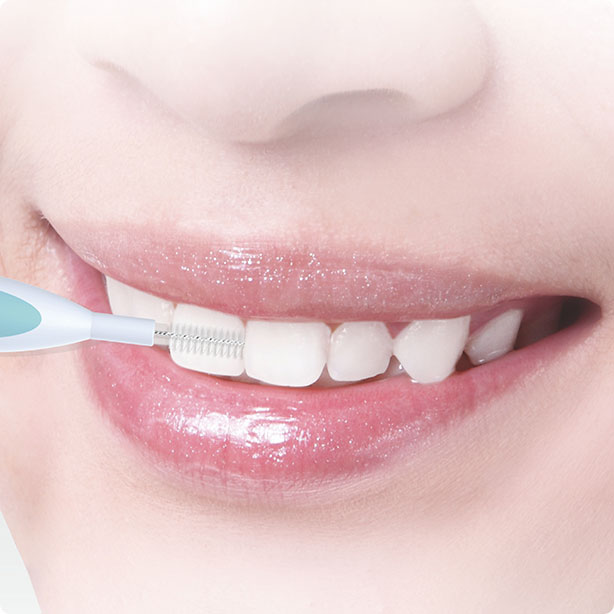 Buletedan-Technologie